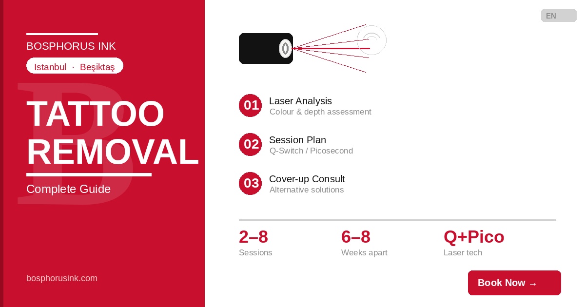 Tattoo Removal Istanbul: Everything You Need to Know Before You Decide