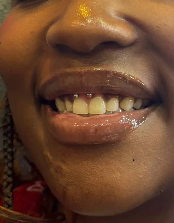 Smiley Piercing Istanbul | Bosphorus Ink - Piercing | Bosphorus Ink Portfolio