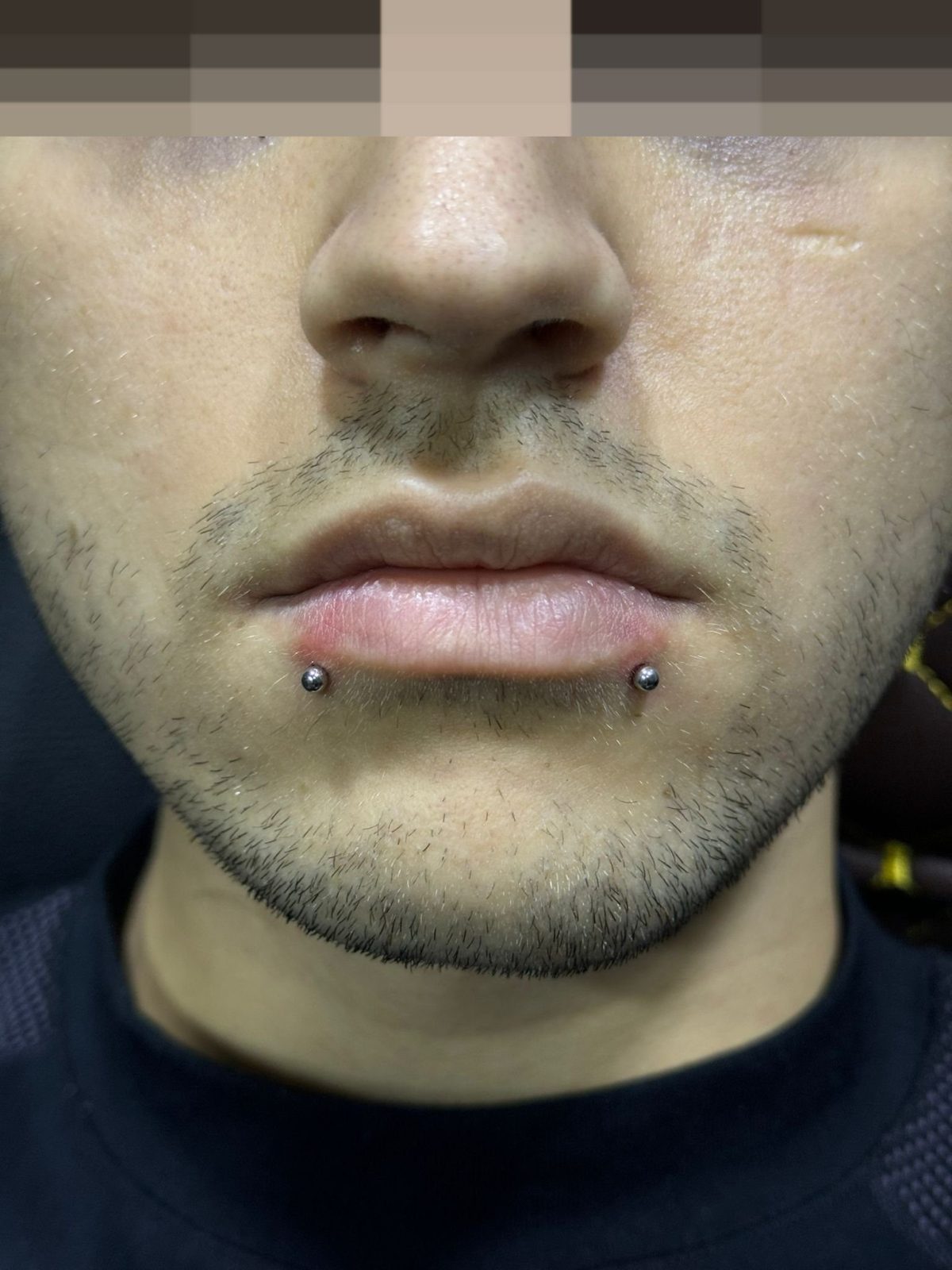 Lippen (Labret) Piercing | Istanbul Bosphorus Ink - Piercing · Buse | Bosphorus Ink Portfolio