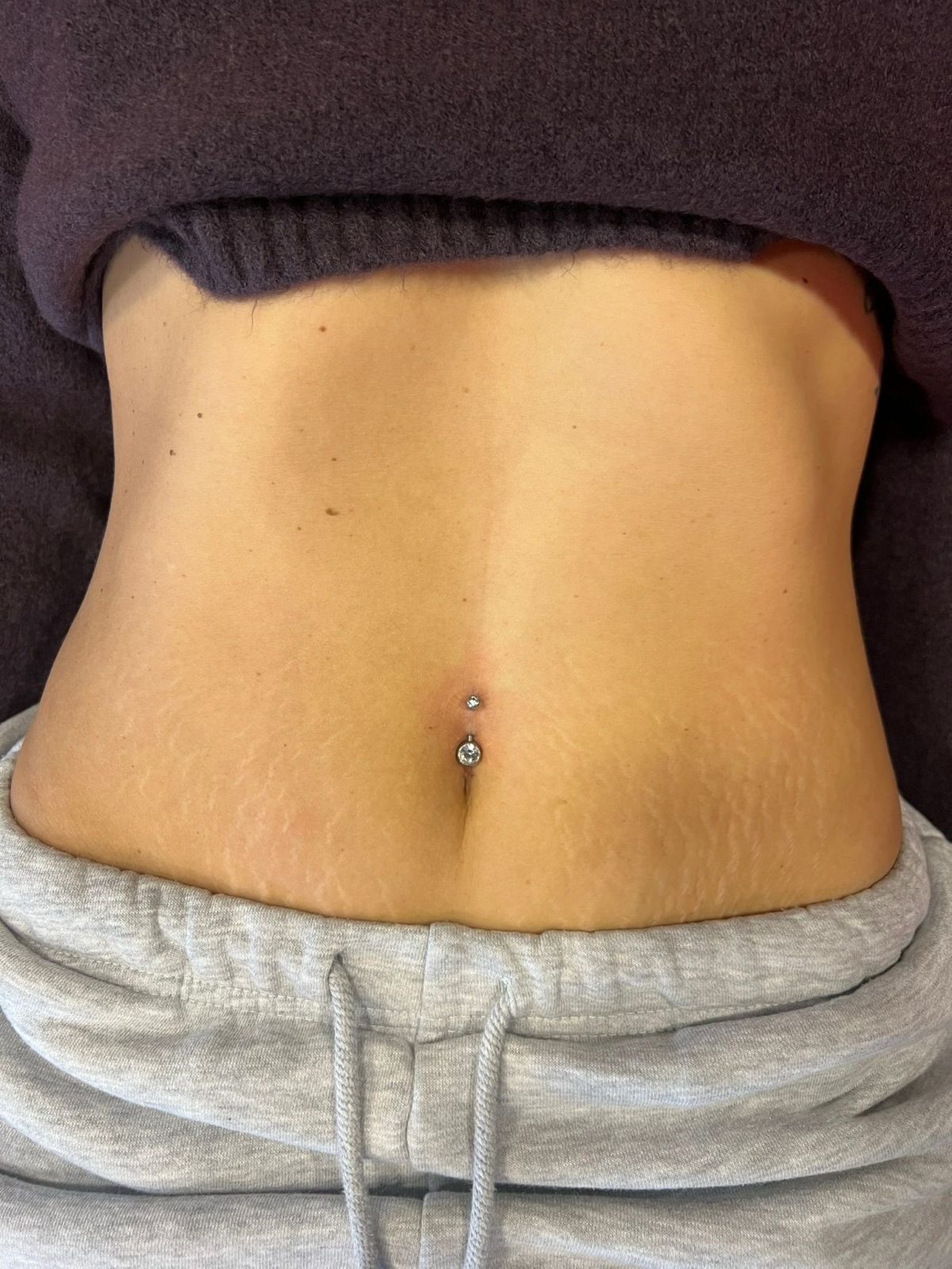Bauchnabel Piercing | Istanbul Bosphorus Ink